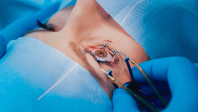 ai-driven-laser-eye-surgery:-how-blue-fin-vision-refines-outcomes-through-smart-surgical-planning